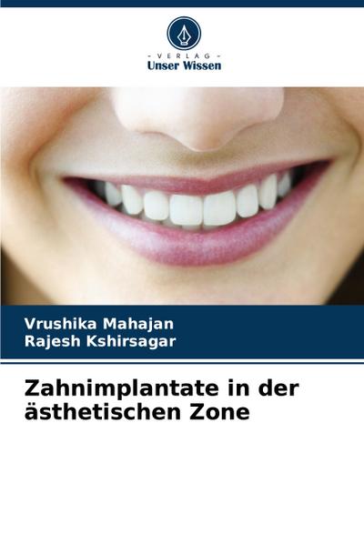 Zahnimplantate in der ästhetischen Zone