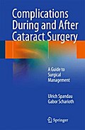 Complications During and After Cataract Surgery