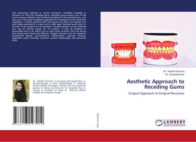 Aesthetic Approach to Receding Gums
