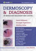 Dermoscopy and Diagnosis of Benign and Malignant Skin Lesions