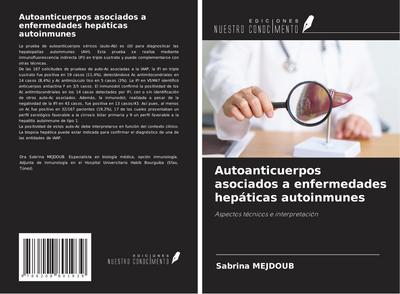 Autoanticuerpos asociados a enfermedades hepáticas autoinmunes