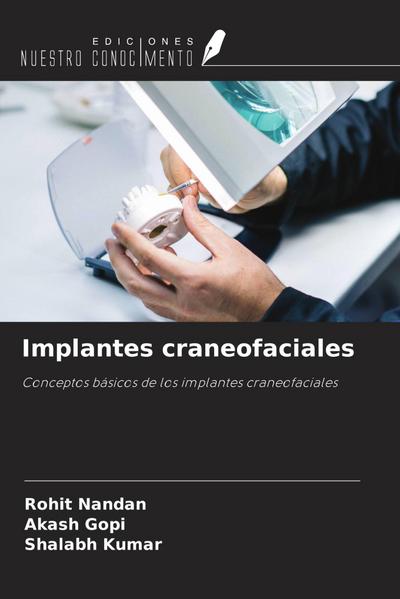 Implantes craneofaciales