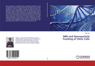 MRI and Nanoparticle Tracking of Stem Cells