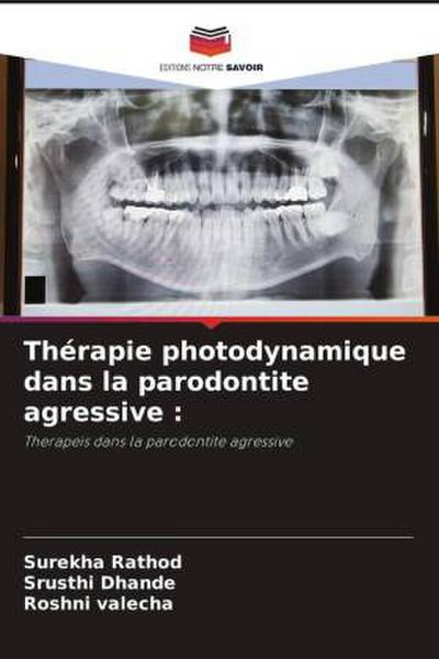 Thérapie photodynamique dans la parodontite agressive :