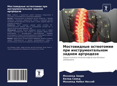 Mostowidnye osteotomii pri instrumental’nom zadnem artrodeze