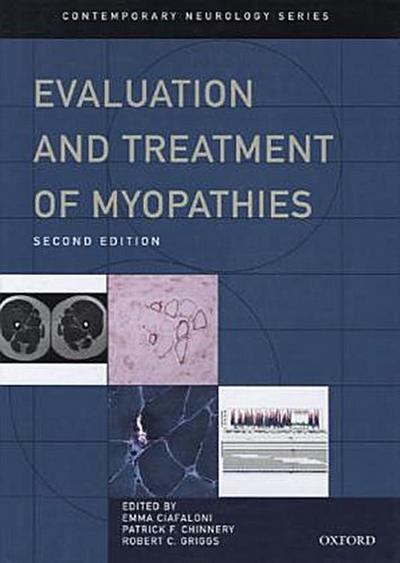 Evaluation and Treatment of Myopathies