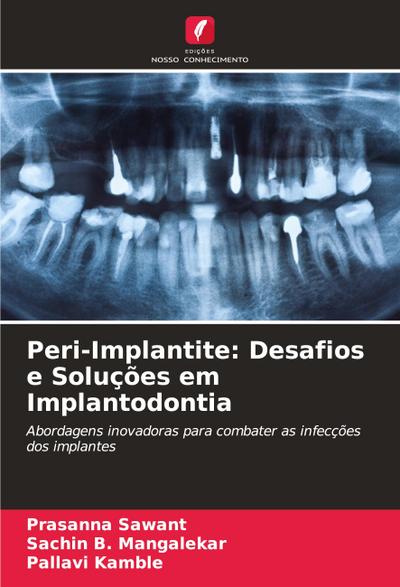 Peri-Implantite: Desafios e Soluções em Implantodontia