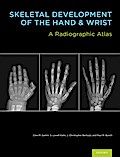 Skeletal Development of the Hand and Wrist