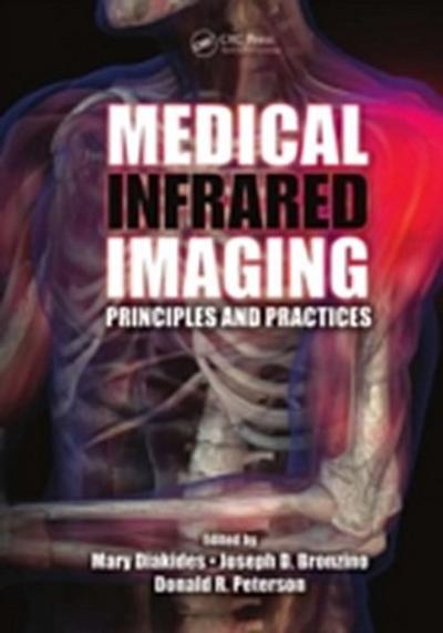 Medical Infrared Imaging