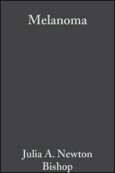Melanoma