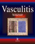 Vasculitis