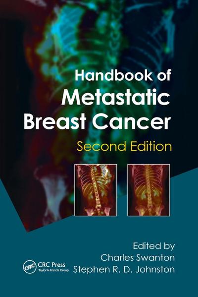 Handbook of Metastatic Breast Cancer
