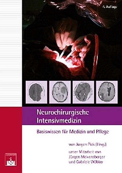 Neurochirurgische ﻿Intensivmedizin