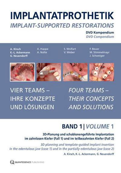 Implantatprothetik. DVD, Band 1