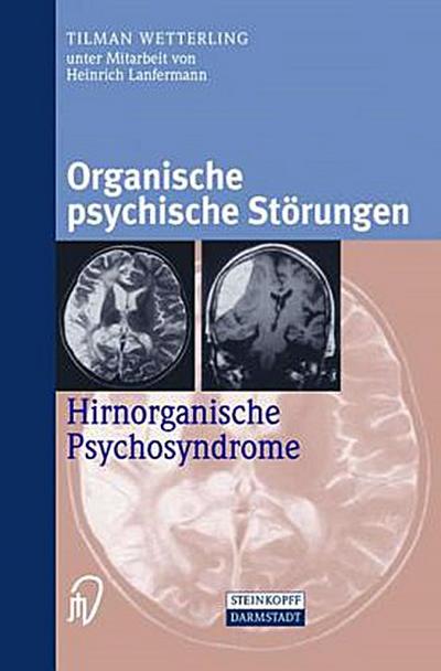 Organische psychische Störungen