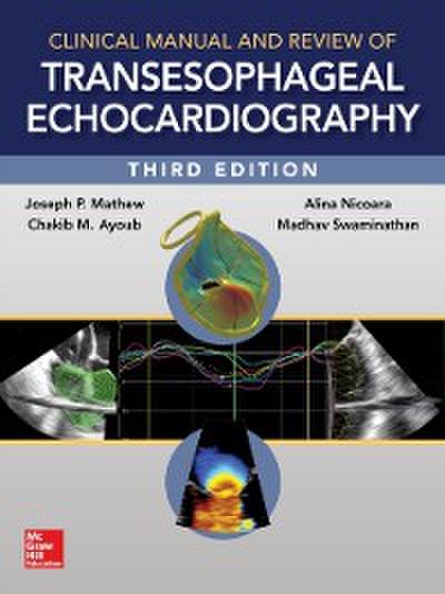 Clinical Manual and Review of Transesophageal Echocardiography, 3/e