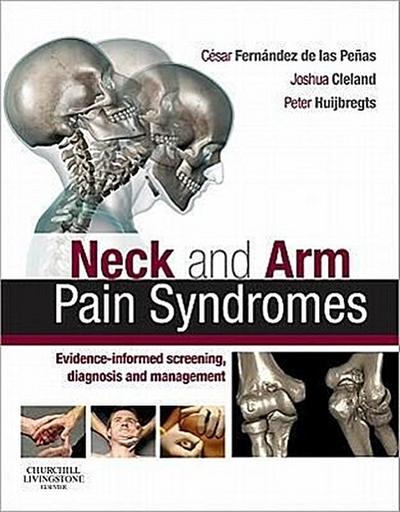 Neck and Arm Pain Syndromes: Evidence-Informed Screening, Diagnosis and Management