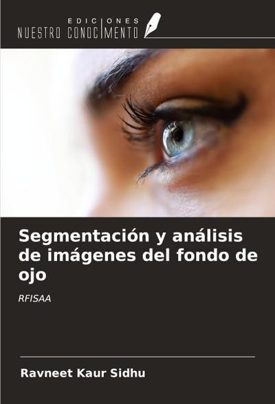 Segmentación y análisis de imágenes del fondo de ojo