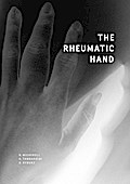 The Rheumatic Hand