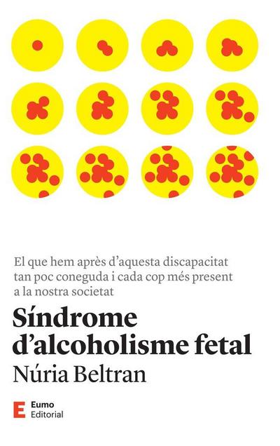 Síndrome d’alcoholisme fetal