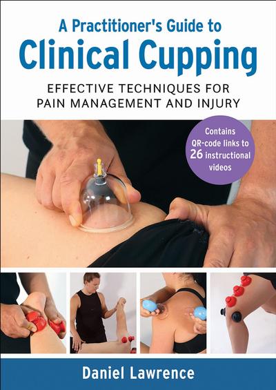 A Practitioner’s Guide to Clinical Cupping