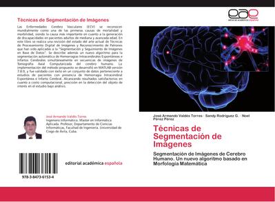 Técnicas de Segmentación de Imágenes
