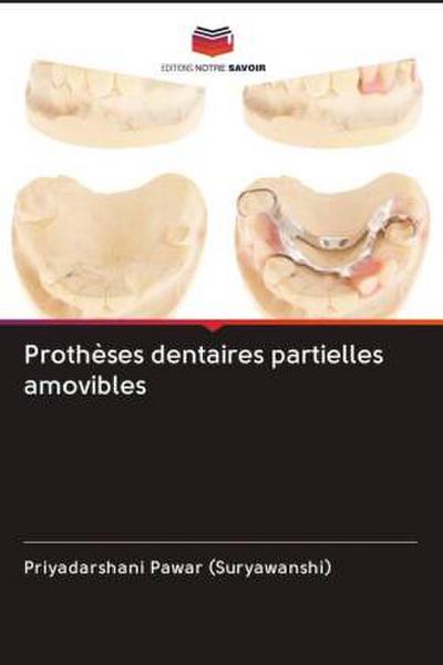 Prothèses dentaires partielles amovibles