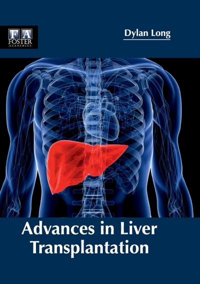Advances in Liver Transplantation