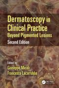 Dermatoscopy in Clinical Practice