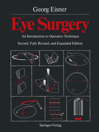 Eye Surgery