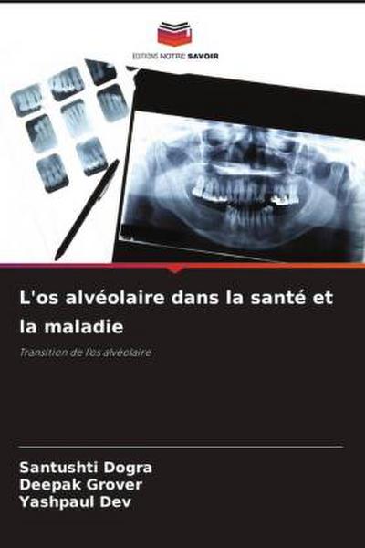 L’os alvéolaire dans la santé et la maladie