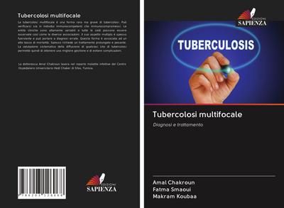 Tubercolosi multifocale