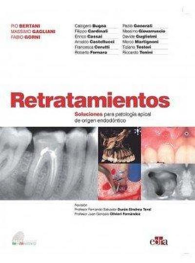 Retratamientos. Soluciones Para Patología Apical de Origen Endodóntico