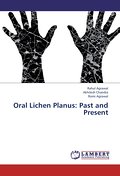 Oral Lichen Planus: Past and Present