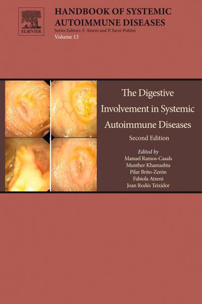 The Digestive Involvement in Systemic Autoimmune Diseases