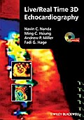 Live/Real Time 3D Echocardiography
