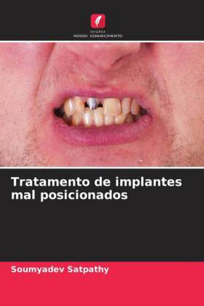 Tratamento de implantes mal posicionados