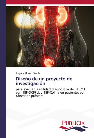 Diseño de un proyecto de investigación