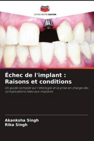 Échec de l’implant : Raisons et conditions