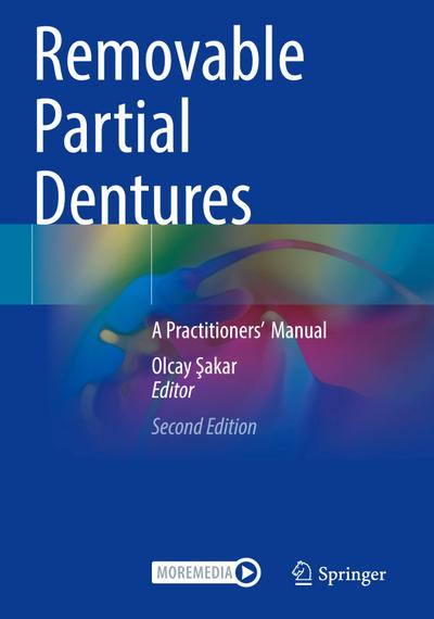 Removable Partial Dentures