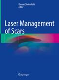 Laser Management of Scars