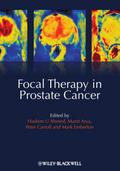 Focal Therapy in Prostate Cancer