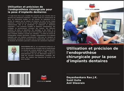 Utilisation et précision de l’endoprothèse chirurgicale pour la pose d’implants dentaires
