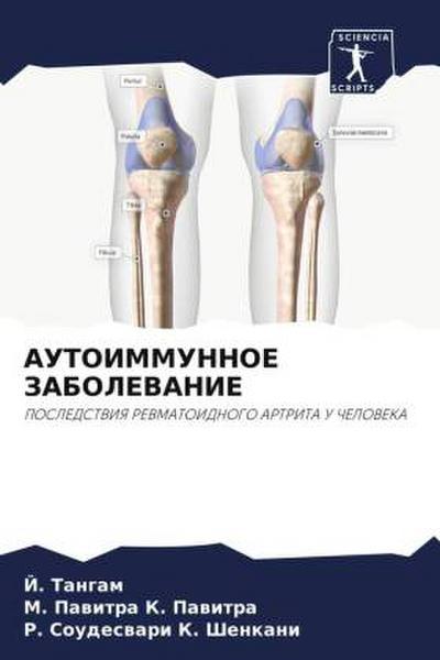AUTOIMMUNNOE ZABOLEVANIE