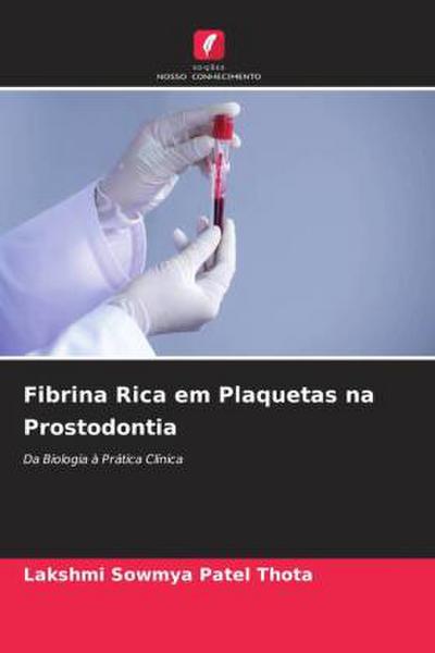 Fibrina Rica em Plaquetas na Prostodontia