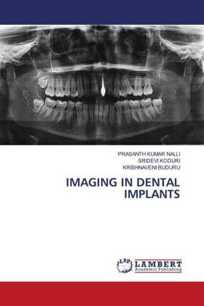 IMAGING IN DENTAL IMPLANTS
