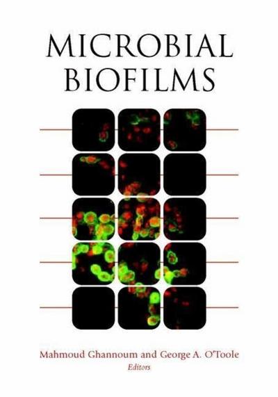 Microbial Biofilms