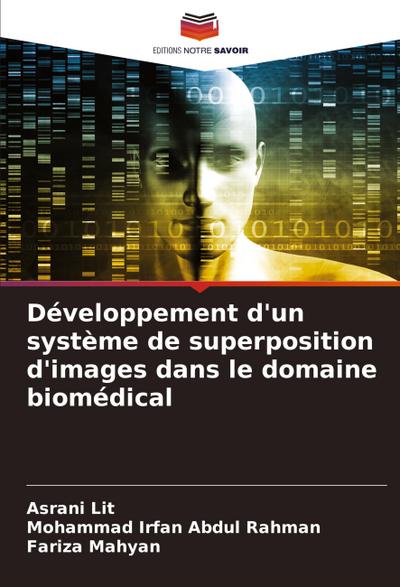 Développement d’un système de superposition d’images dans le domaine biomédical
