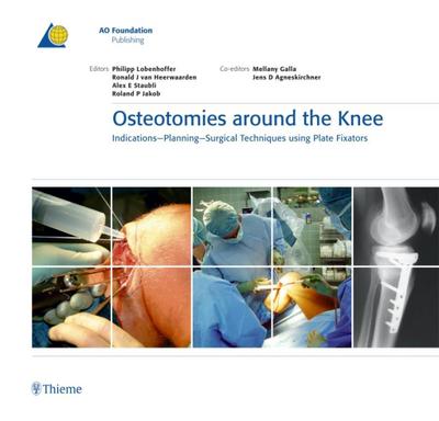 Osteotomies around the Knee