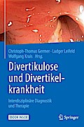 Divertikulose und Divertikelkrankheit